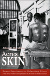 ACRES OF SKIN (HUMAN EXPERIMENTS AT HOLMESBURG PRISON)